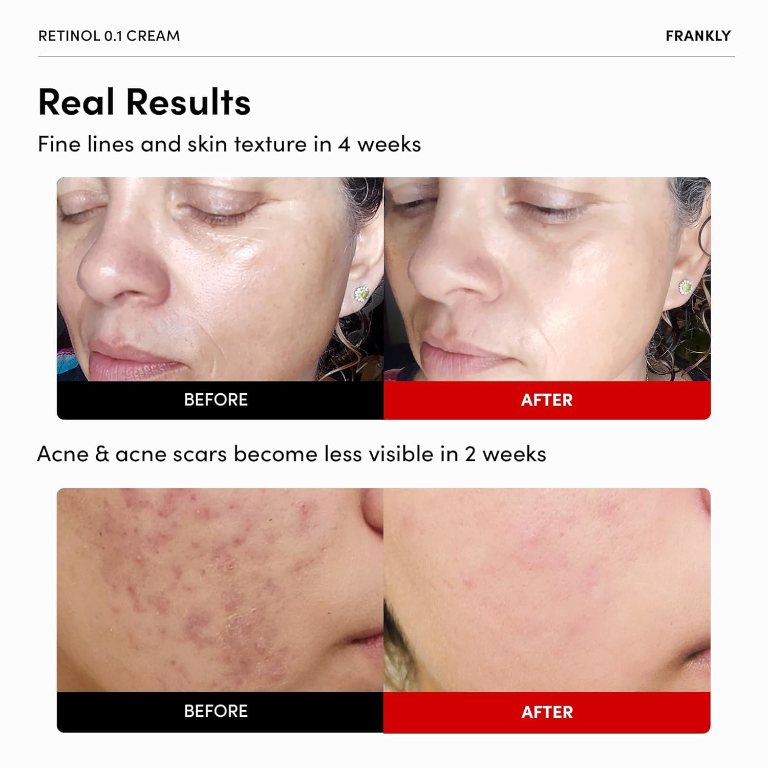 FRANKLY Retinol 0.1% Night Cream | LibrasLuxury