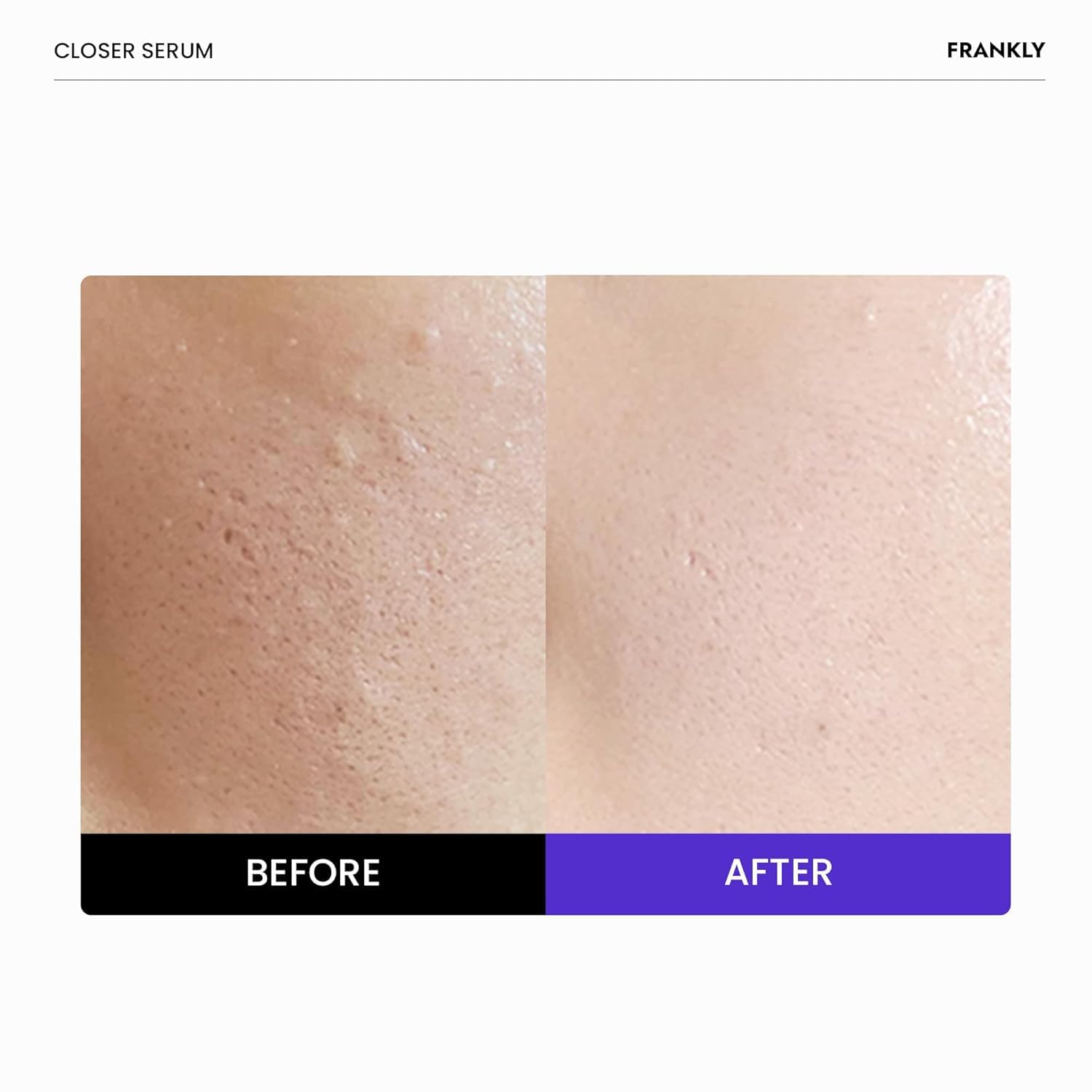 FRANKLY Closer Pore Minimizer Serum | LibrasLuxury