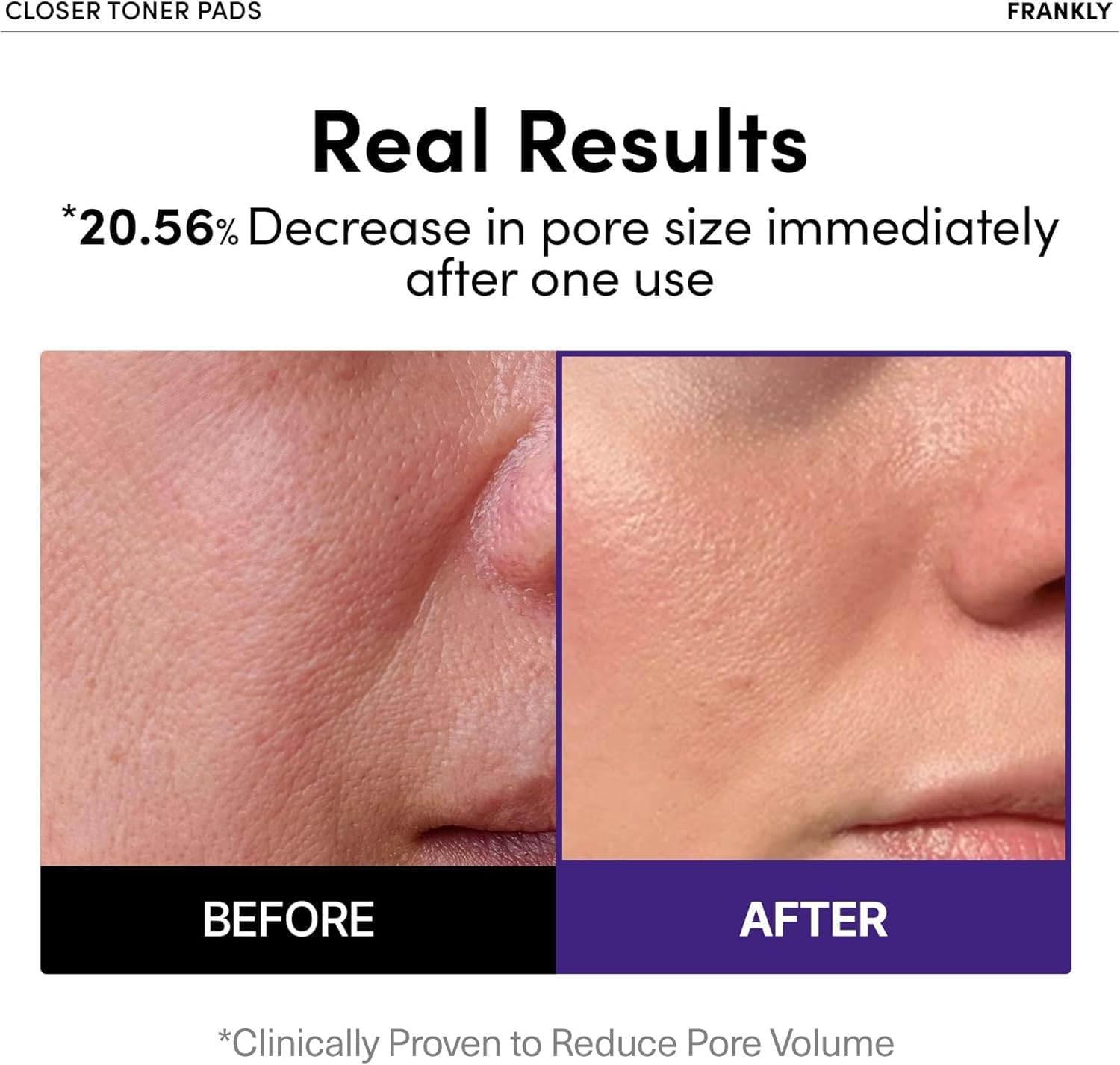 FRANKLY Rice Jelly Toner Pads | LibrasLuxury