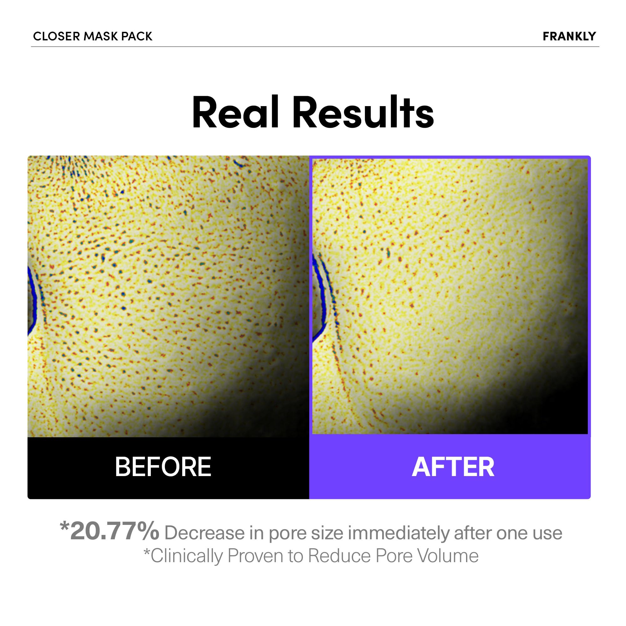 FRANKLY Closer Pore Minimizing Sheet Mask | LibrasLuxury